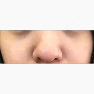 韓国BBクリニック（旧 シンミアン形成外科）口コミ