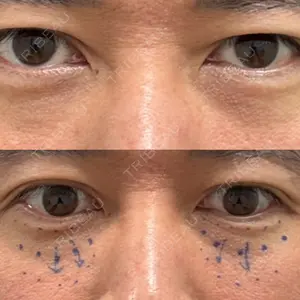 EMMO FACE CLINIC 東京三田院口コミ