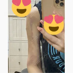 Lipo Clinic omotesando口コミ