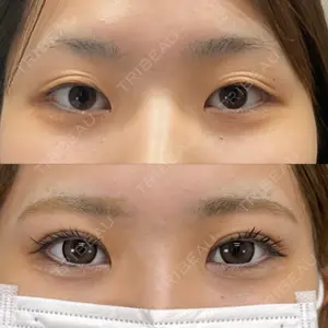 ネビュラクリニック 京都院口コミ