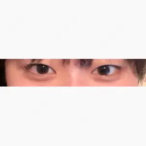 アリエル美容クリニック 大宮院口コミ
