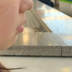 リエンジャン整形外科 弘大店口コミ