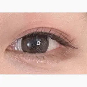 フローラクリニック口コミ