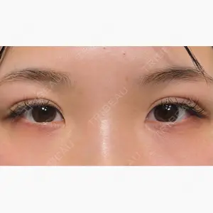 HAAB×DREAM BEAUTY CLINIC 大阪梅田院口コミ