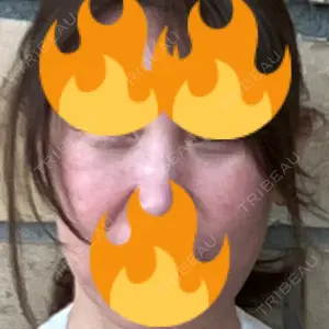 X CLINIC 大阪院口コミ