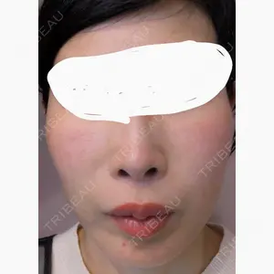 LOCHIC CLINIC GINZA【ロシッククリニック銀座】口コミ