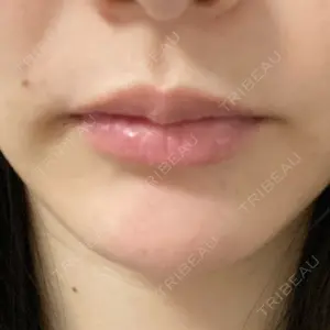 R Beauty CLINIC 銀座院口コミ