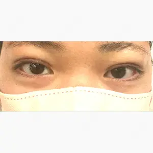 アリエル美容クリニック 大宮院口コミ