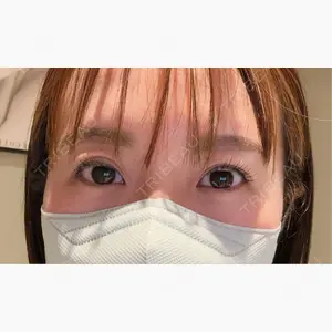 HAAB×DREAM BEAUTY CLINIC 東京本院口コミ