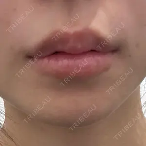 R Beauty CLINIC 銀座院口コミ