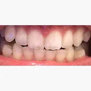 RIVER CLINIC DENTAL口コミ