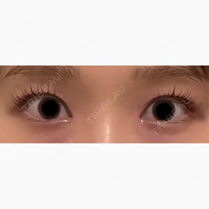 東京イセアクリニック口コミ