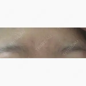 新宿皮膚科ゆうスキンクリニック 新宿院口コミ