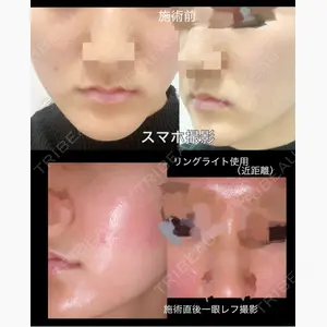 東京美容クリニック 表参道本院口コミ