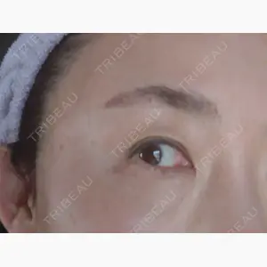 X CLINIC 大阪院口コミ