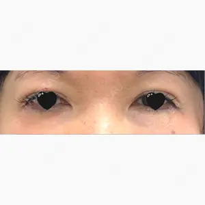 TCB東京中央美容外科 徳島院口コミ