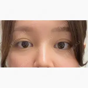R Beauty CLINIC 大阪院口コミ