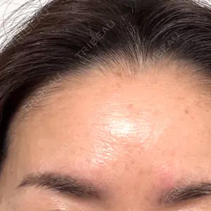 veary clinic口コミ