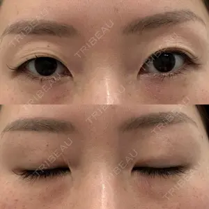 湘南美容クリニック 枚方院口コミ