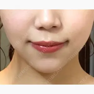 藤井美容外科口コミ