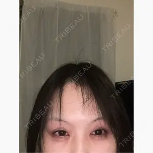 TCB東京中央美容外科 立川院口コミ