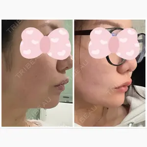 東京形成美容外科 船橋院口コミ