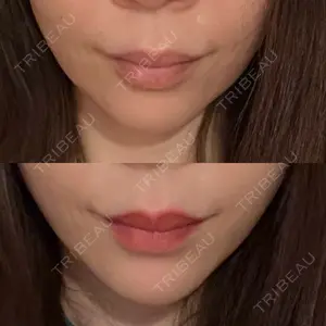 ヴェリテクリニック 大阪院口コミ