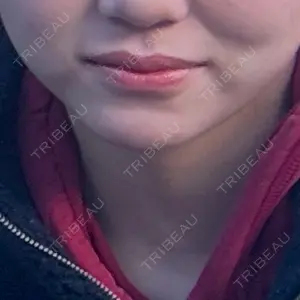 TCB東京中央美容外科 草津院口コミ