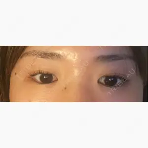 NARU Beauty Clinic 【ナルクリ】口コミ