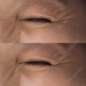 PRISM Beauty Clinic口コミ