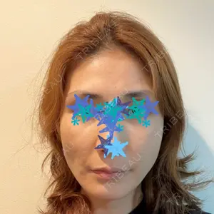 セギム美容整形外科口コミ