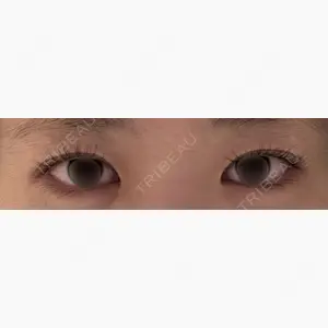 LUHO（ルホ）美容外科口コミ