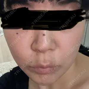 ASTRA BEAUTY CLINIC口コミ