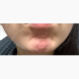 代々木駅前美容クリニック口コミ