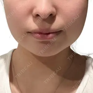 X CLINIC 大阪院口コミ