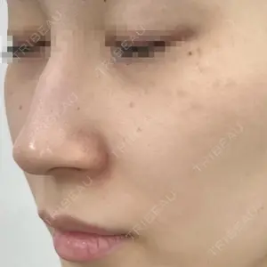 APスキンクリニック銀座口コミ
