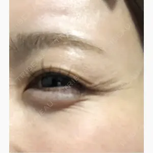 Natural Skin Clinic 笹塚院口コミ