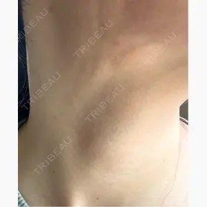 TCB東京中央美容外科 宇都宮院口コミ