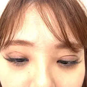 HAAB×DREAM BEAUTY CLINIC 東京本院口コミ