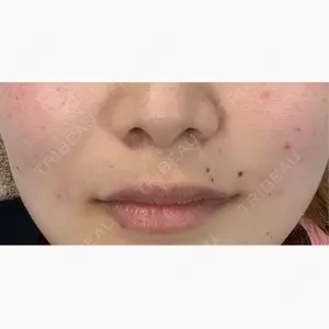 プラザ美容外科口コミ