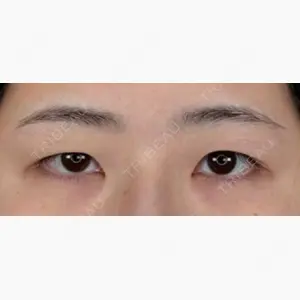 アリエル美容クリニック 大宮院口コミ