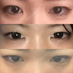 共立美容外科 高崎院口コミ