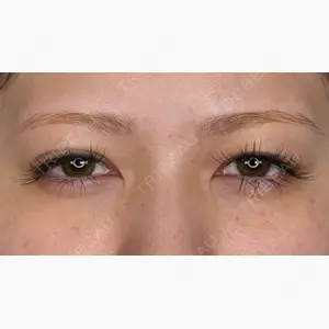 アリエル美容クリニック 大宮院口コミ