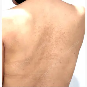 ブリリアスキンクリニック口コミ