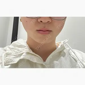 TCB東京中央美容外科 越谷院口コミ