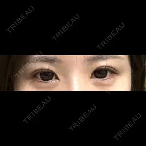 TCB東京中央美容外科 なんば院口コミ