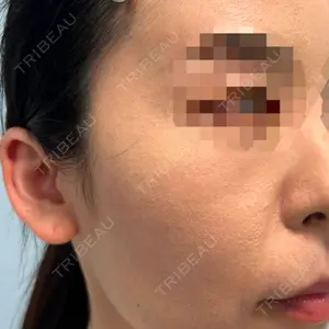 プラザ美容外科口コミ