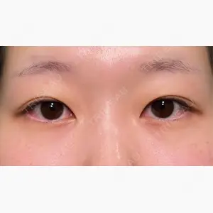 HAAB×DREAM BEAUTY CLINIC 大阪梅田院口コミ