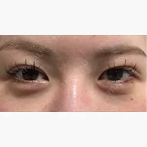 LUHO（ルホ）美容外科口コミ
