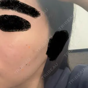 あいちビューティークリニック口コミ